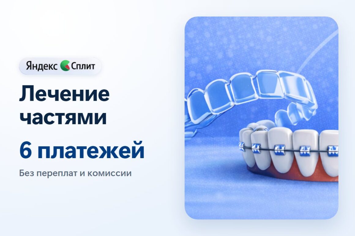 Лечение частями через Яндекс Сплит