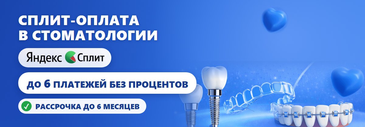 Сплит-оплата в стоматологии: до 6 платежей без процентов